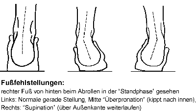 Fussfehlstellungen - berpronation und Supination